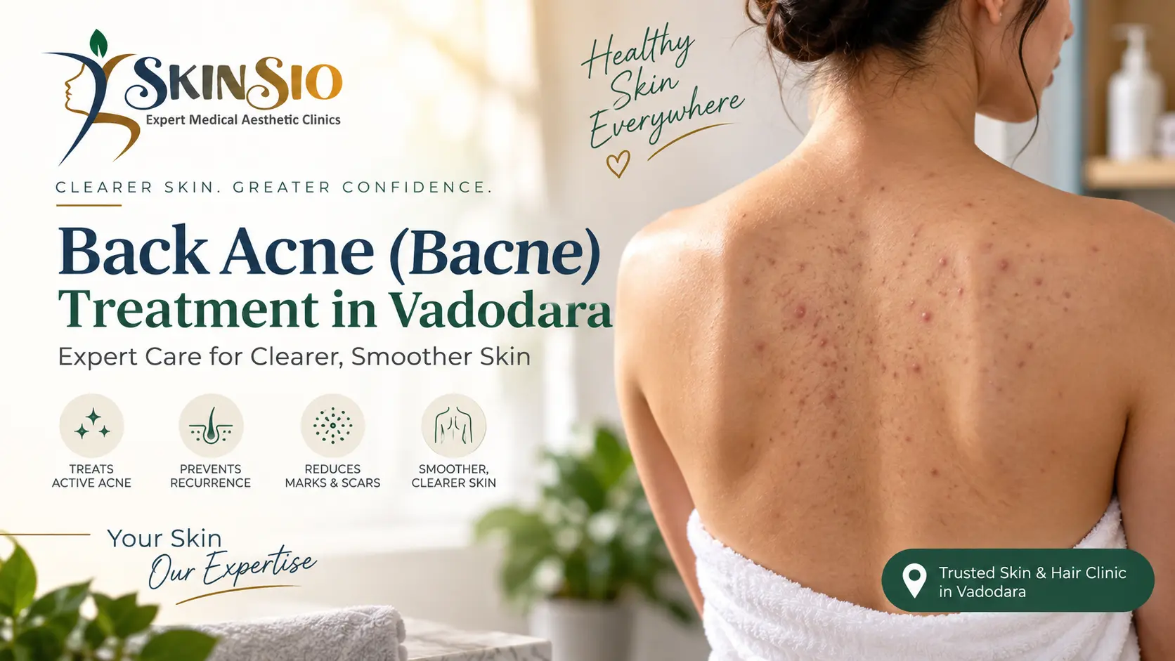 Back Acne Treatment in Vadodara: Causes, Care & When to See a Dermatologist
