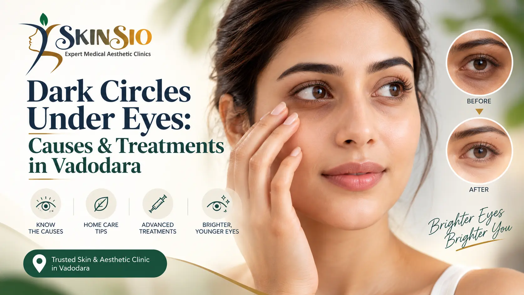 Dark Circles Under Eyes: Causes, Treatments & What Actually Works in Vadodara