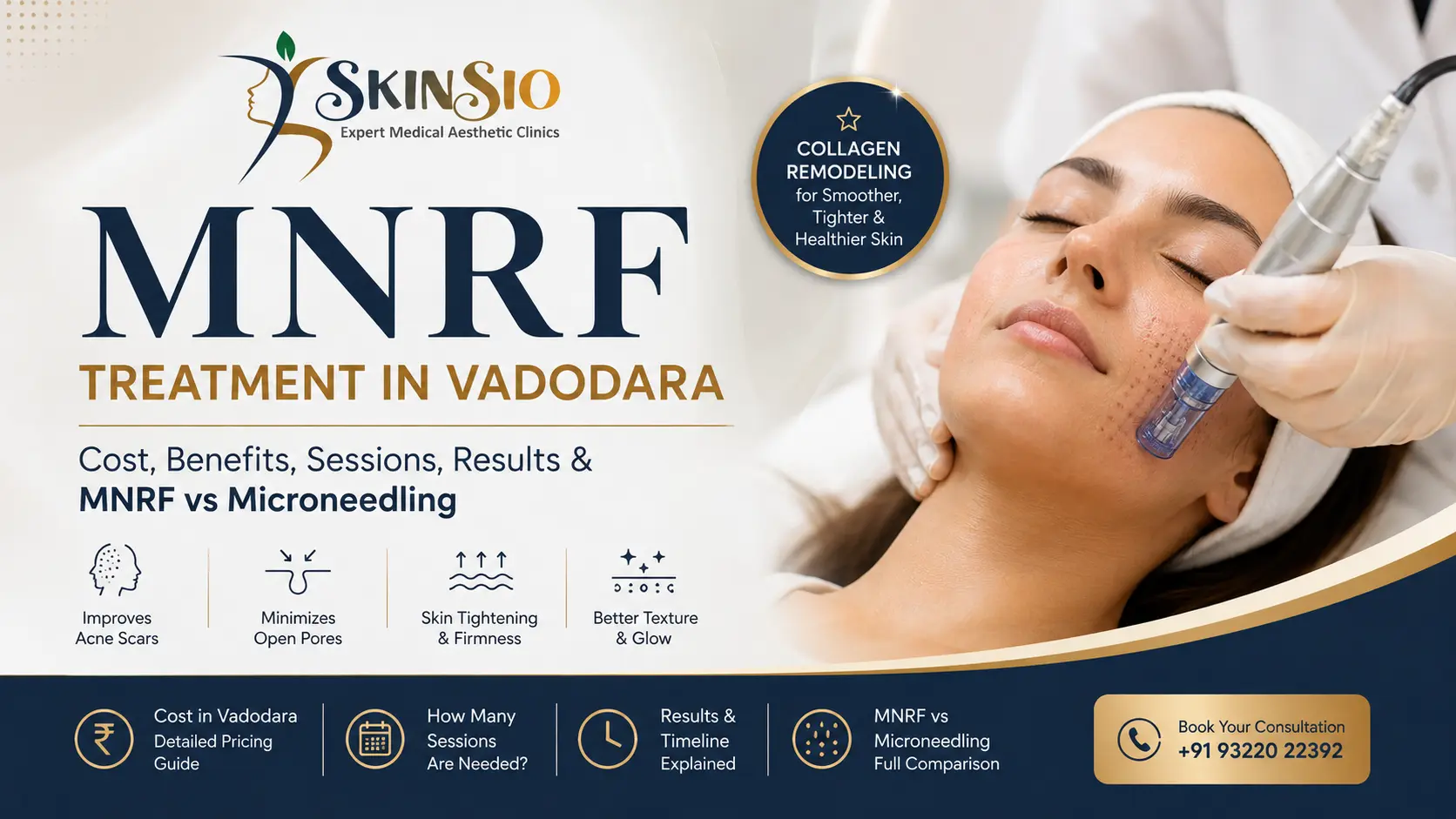 MNRF Treatment in Vadodara: Cost, Benefits, Sessions & MNRF vs Microneedling Explained