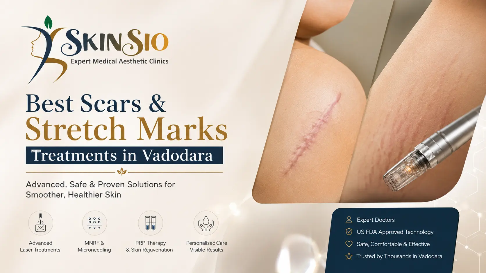 Best Scar & Stretch Mark Treatments in Vadodara: Lasers, RF Microneedling, PRP & TCA CROSS Compared