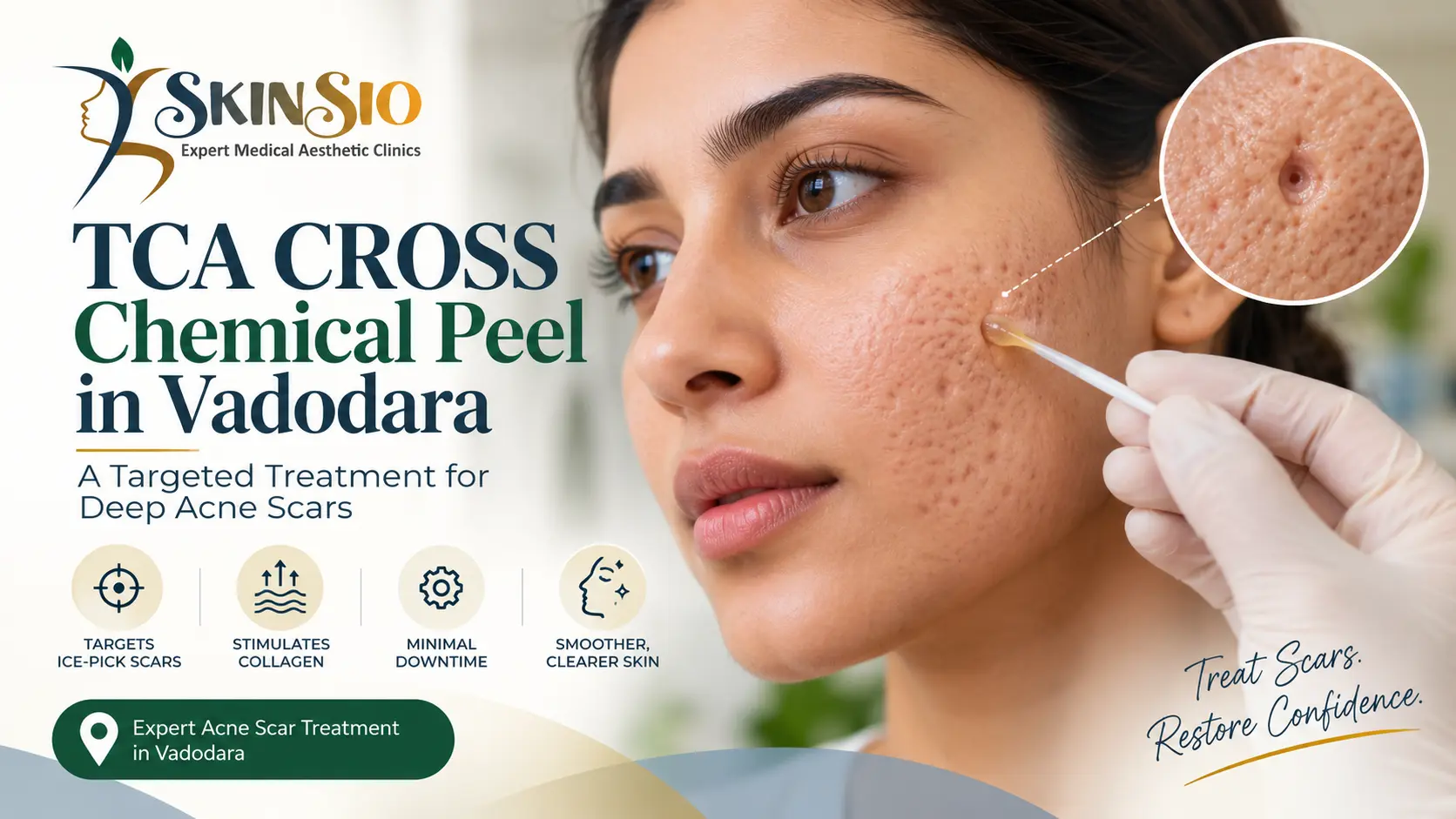 TCA CROSS Treatment in Vadodara: How It Works, Who Needs It & What to Expect
